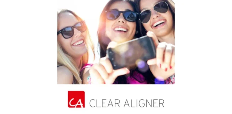 aligner